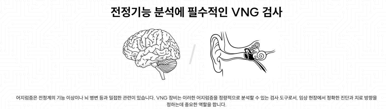 전정기능 분석 VNG 검사