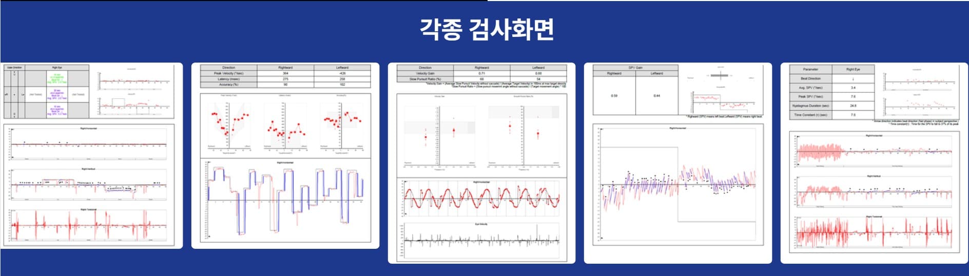 VNG 각종 검사화면